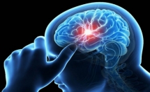 تحذير من السكتة الدماغية .. 7 أعراض لا تتجاهلها
