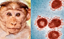 الصحة العالمية تستبعد أن يؤدي انتشار جدري القردة إلى جائحة